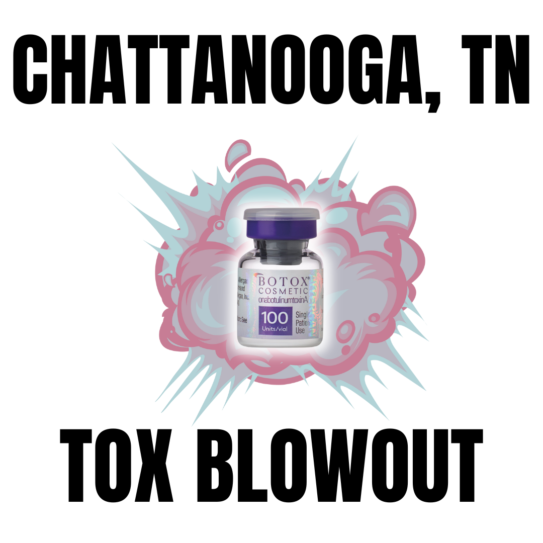 Chattanooga - 30% OFF Tox Blowout (Neurotoxin ONLY)